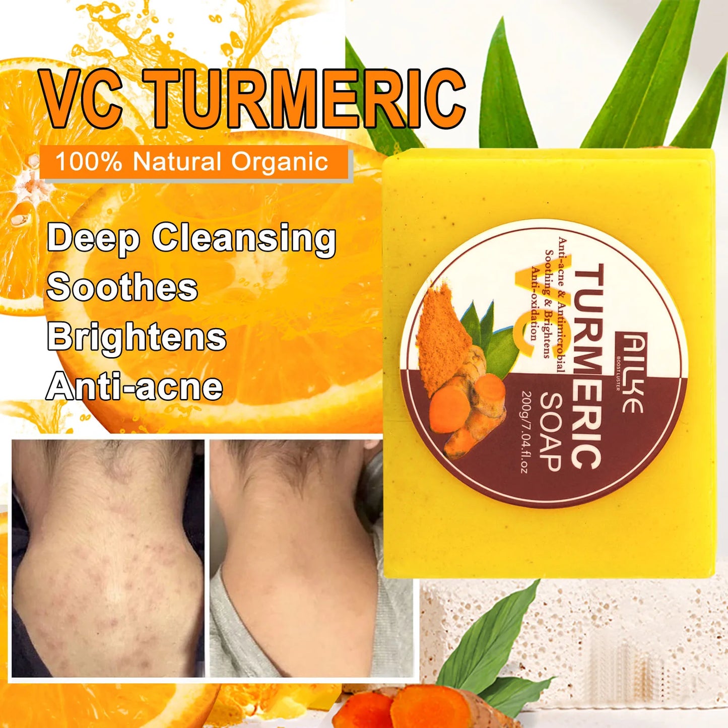 AILKE Turmeric Acne Bath Soap for Face and Body Brightening