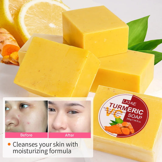 AILKE Turmeric Acne Bath Soap for Face and Body Brightening