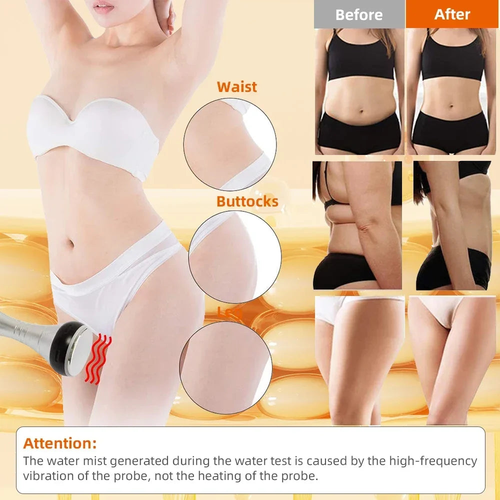 Missheart Cavitation Ultrasonic Body Slimming Machine Vacuum Suction