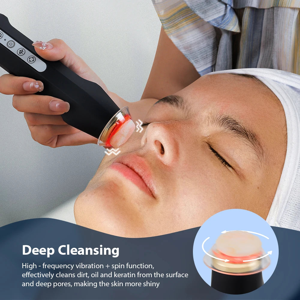 Foreverlily Oxygen Bubble Pen CO2 Facial Spa Device