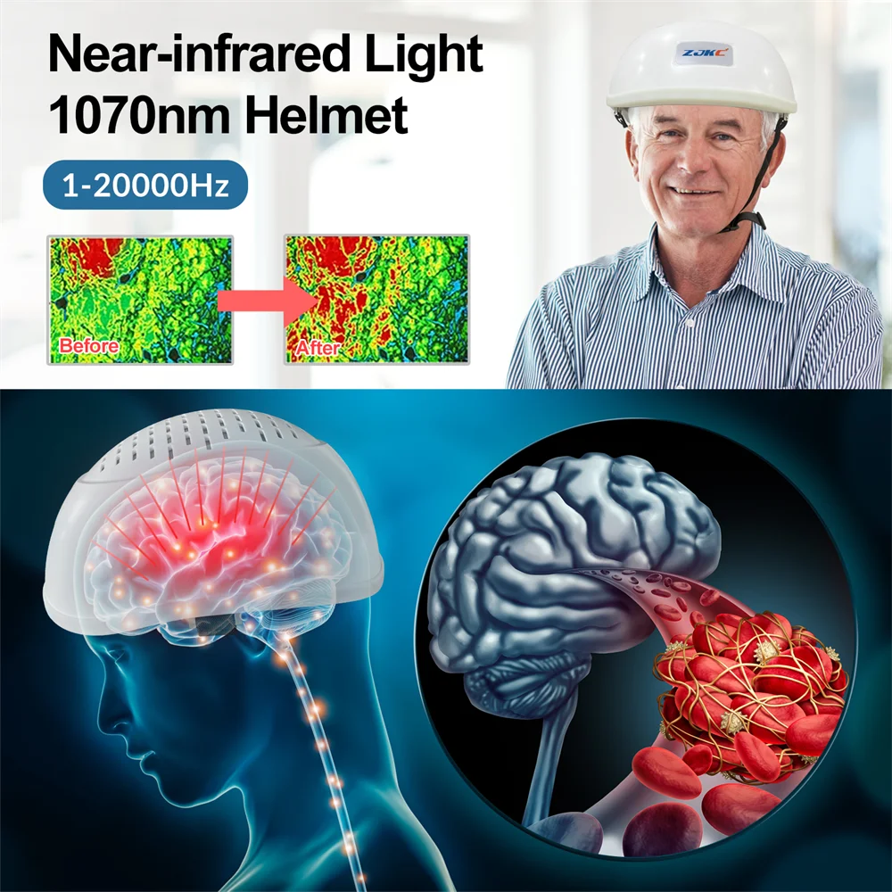 ZJKC Infrared Light Therapy Helmet 1070nm For Dementia Cognition