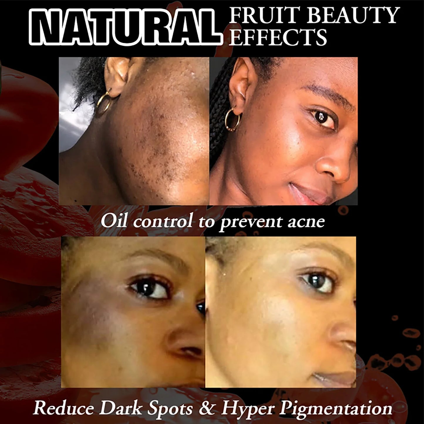 AILKE Tomato Whitening Soap for Face and Body Dark Spots