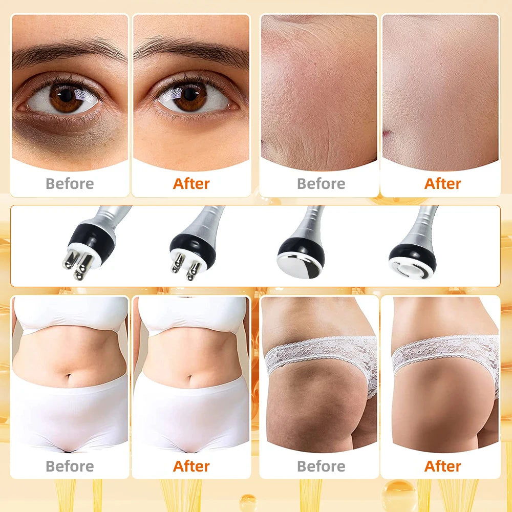 Missheart Cavitation Ultrasonic Body Slimming Machine Vacuum Suction